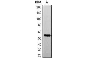 Image no. 3 for anti-GTPase Activating Protein (SH3 Domain) Binding Protein 1 (G3BP1) (pSer232) antibody (ABIN2706195)