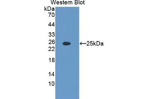 Interleukin 35 antibody  (AA 23-215)