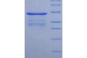 Image no. 1 for Brain Natriuretic Peptide (BNP) (AA 27-121) protein (His tag,GST tag) (ABIN1878440)