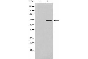 Image no. 1 for anti-Dystrophia Myotonica-Protein Kinase (DMPK) antibody (ABIN6261318)