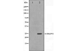 Image no. 2 for anti-Synaptosomal-Associated Protein, 25kDa (SNAP25) (C-Term) antibody (ABIN6265203)