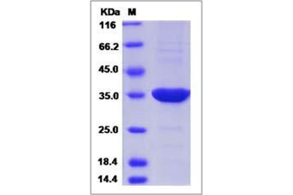Phosphatidylinositol Transfer Protein, alpha (PITPNA) (AA 1-270) protein (His tag)