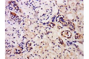 Formalin-fixed and paraffin embedded human kidney labeled with Anti-Caspase-6 Polyclonal Antibody, Unconjugated  at 1:200 followed by conjugation to the secondary antibody and DAB staining.