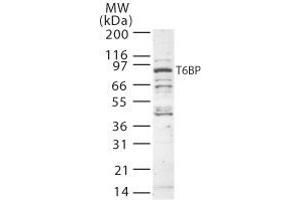 Image no. 1 for anti-Tax1 (Human T-Cell Leukemia Virus Type I) Binding Protein 1 (TAX1BP1) (AA 700-800) antibody (ABIN208885)