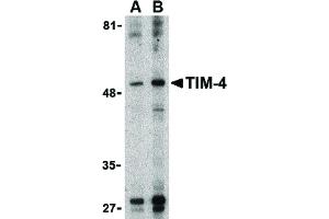 Image no. 1 for anti-T-Cell Immunoglobulin and Mucin Domain Containing 4 (TIMD4) (Internal Region) antibody (ABIN6655881)