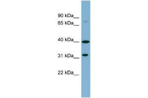 Image no. 1 for anti-Ferric-Chelate Reductase 1 Like (FRRS1L) (Middle Region) antibody (ABIN2782804)
