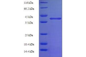 Image no. 1 for N-6 Adenine-Specific DNA Methyltransferase 2 (Putative) (N6AMT2) (AA 2-214) protein (His-SUMO Tag) (ABIN5711529)