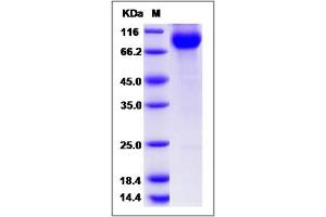Image no. 1 for CUB Domain Containing Protein 1 (CDCP1) (AA 1-343) protein (Fc Tag) (ABIN2005620)