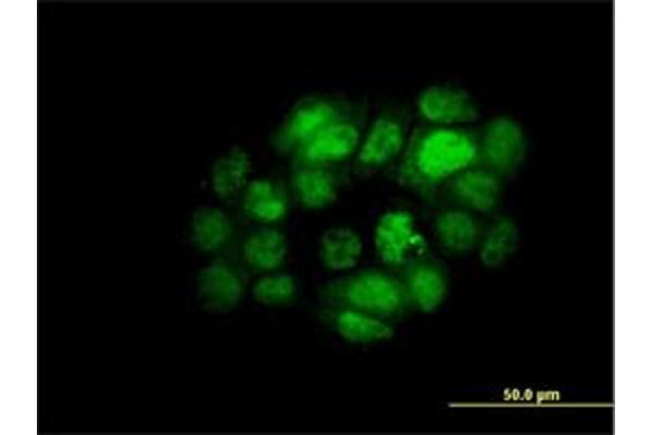 IRF5 anticorps  (AA 395-504)