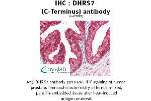 Image no. 2 for anti-Dehydrogenase/reductase (SDR Family) Member 7 (DHRS7) (C-Term) antibody (ABIN1733630)