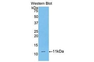 Image no. 1 for anti-CD3d Molecule, delta (CD3-TCR Complex) (CD3D) (AA 22-103) antibody (ABIN1175142)