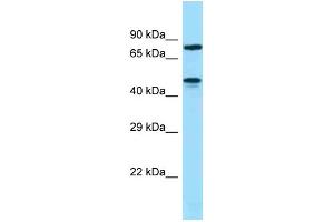 Image no. 1 for anti-Zinc Finger Protein 311 (ZNF311) (N-Term) antibody (ABIN2784158)