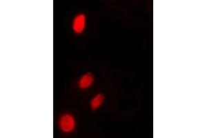 anti-Tumor Protein P53 Inducible Nuclear Protein 2 (TP53INP2) (N-Term) antibody