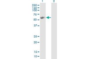 Image no. 1 for anti-Glycerol Kinase (GK) (AA 1-524) antibody (ABIN516043)