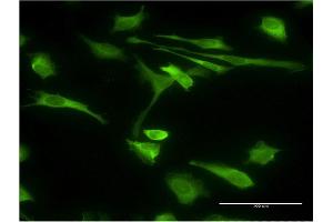 Image no. 8 for anti-Stress-Induced-phosphoprotein 1 (STIP1) (AA 1-543) antibody (ABIN524365)