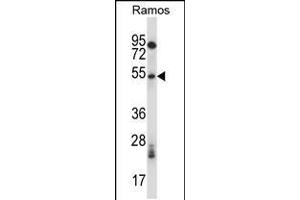 Image no. 1 for anti-phosphorylase Kinase, gamma 1 (Muscle) (PHKG1) (AA 302-331), (C-Term) antibody (ABIN5537752)