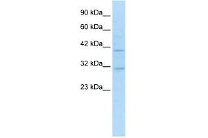 Image no. 4 for anti-Sirtuin 6 (SIRT6) (N-Term) antibody (ABIN2779625)