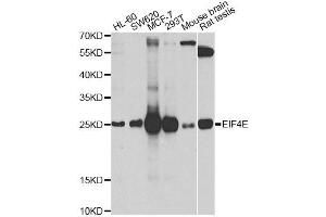 Image no. 5 for anti-Eukaryotic Translation Initiation Factor 4E (EIF4E) antibody (ABIN3023085)