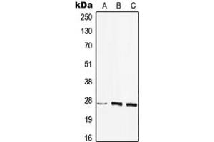 Image no. 1 for anti-Major Histocompatibility Complex, Class II, DQ beta 2 (HLA-DQB2) (Center) antibody (ABIN2706314)