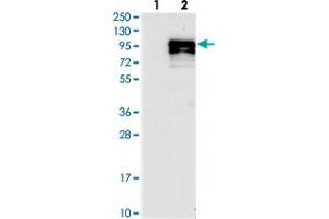 Image no. 2 for anti-Coiled-Coil Domain Containing 82 (CCDC82) antibody (ABIN5573931)