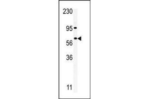 Image no. 1 for anti-RIO Kinase 1 (RIOK1) (AA 522-551), (C-Term) antibody (ABIN391302)