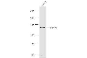 Image no. 1 for anti-Homeodomain Interacting Protein Kinase 1 (HIPK1) (AA 1-100) antibody (ABIN5675039)