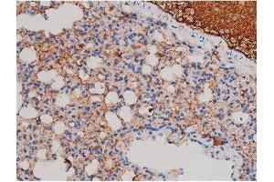 Image no. 7 for anti-V-Akt Murine Thymoma Viral Oncogene Homolog 1 (AKT1) (pSer124) antibody (ABIN6256119)