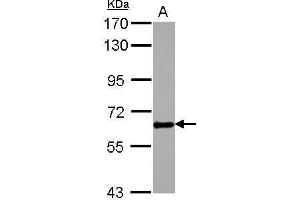 Image no. 1 for anti-Osteoactivin (GPNMB) (Internal Region) antibody (ABIN2855599)