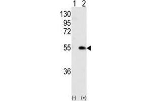 Image no. 2 for anti-Calcium/calmodulin-Dependent Protein Kinase IG (CAMK1G) (Center) antibody (ABIN359471)