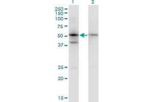 Image no. 1 for anti-serpin Peptidase Inhibitor, Clade B (Ovalbumin), Member 1 (SERPINB1) (AA 201-300) antibody (ABIN515235)