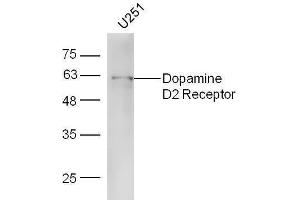 Dopamine d2 Receptor 抗体  (AA 201-300)