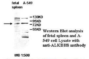 Image no. 1 for anti-Platelet-Derived Growth Factor CC (PDGFCC) antibody (ABIN790864)