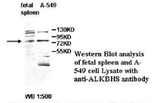 Platelet-Derived Growth Factor CC (PDGFCC) antibody