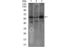 Image no. 3 for anti-Fc Fragment of IgE Receptor Ia (FCER1A) (AA 42-103) antibody (ABIN1724786)