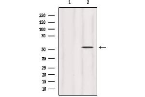 Image no. 3 for anti-Homocysteine-Inducible, Endoplasmic Reticulum Stress-Inducible, Ubiquitin-Like Domain Member 1 (HERPUD1) (N-Term) antibody (ABIN6262218)