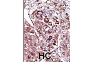 Image no. 2 for anti-Diacylglycerol Kinase, zeta (DGKZ) (AA 989-1019), (C-Term) antibody (ABIN392631)