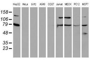 Image no. 6 for anti-Sec1 Family Domain Containing 1 (SCFD1) antibody (ABIN1500818)