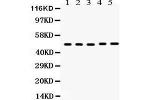 Image no. 4 for anti-Vitamin D Receptor (VDR) (AA 377-402), (C-Term) antibody (ABIN3043960)