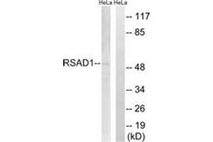 Image no. 1 for anti-Radical S-Adenosyl Methionine Domain Containing 1 (RSAD1) (AA 298-347) antibody (ABIN1535255)