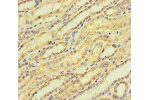 Immunohistochemistry of paraffin-embedded human kidney tissue using ABIN7143108 at dilution of 1:100