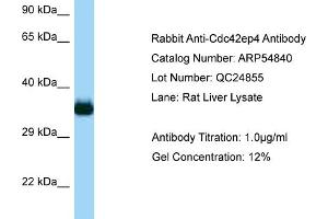 Image no. 1 for anti-CDC42 Effector Protein (Rho GTPase Binding) 4 (CDC42EP4) (Middle Region) antibody (ABIN2774088)