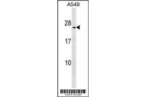 Image no. 1 for anti-Methyltransferase Like 7B (METTL7B) (AA 37-63), (N-Term) antibody (ABIN1539320)