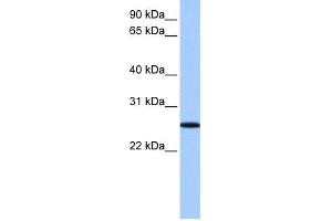 Image no. 1 for anti-F-Box Protein 36 (FBXO36) (N-Term) antibody (ABIN2785331)