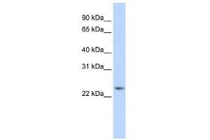 Image no. 1 for anti-RAB8A, Member RAS Oncogene Family (RAB8A) (Middle Region) antibody (ABIN926981)