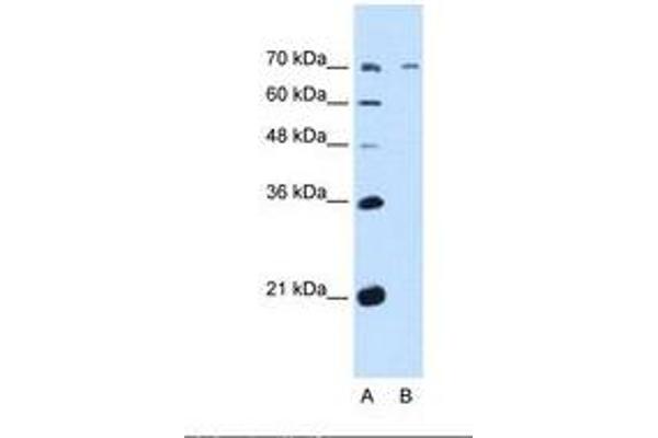 GALNT6 antibody  (AA 61-110)