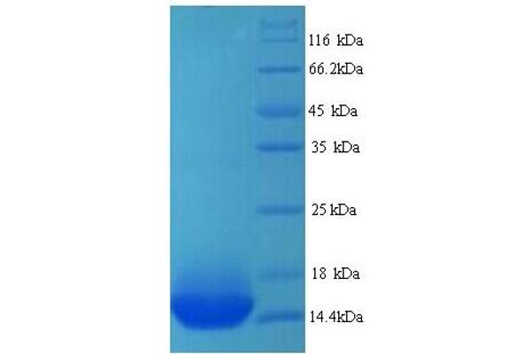 ADRB1 Protein (AA 378-477) (His tag)