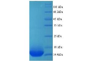 ADRB1 Protein (AA 378-477) (His tag)
