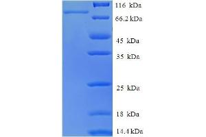 Image no. 1 for RAR-Related Orphan Receptor C (RORC) (AA 1-518), (full length) protein (His-SUMO Tag) (ABIN5710270)