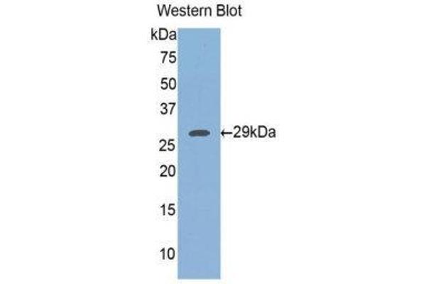 anti-FK506 Binding Protein 8, 38kDa (FKBP8) (AA 93-339) antibody
