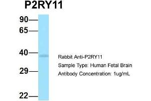 Image no. 1 for anti-Purinergic Receptor P2Y, G-Protein Coupled, 11 (P2RY11) (C-Term) antibody (ABIN2789721)